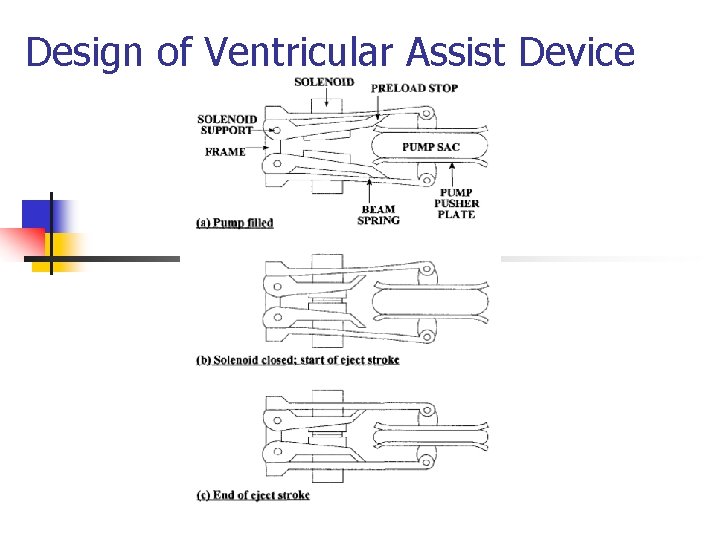 Design of Ventricular Assist Device 