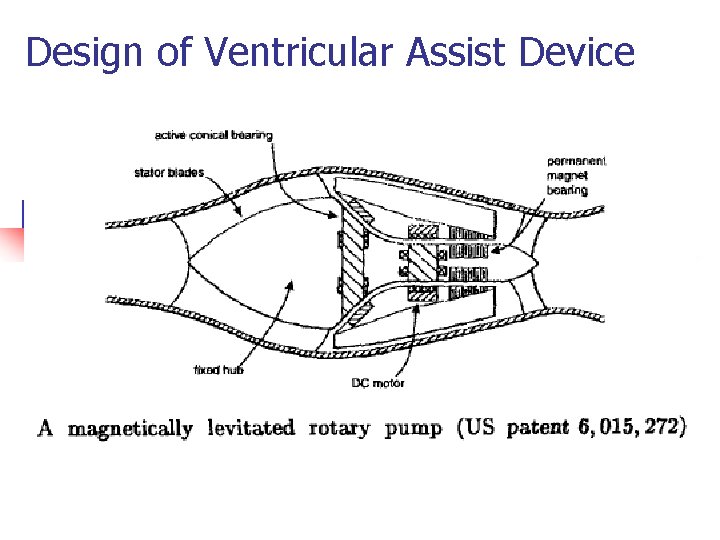 Design of Ventricular Assist Device 