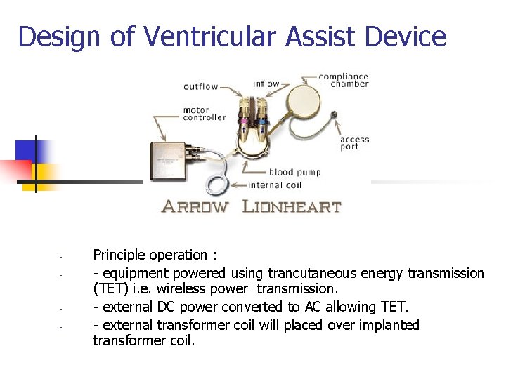Design of Ventricular Assist Device - - Principle operation : - equipment powered using