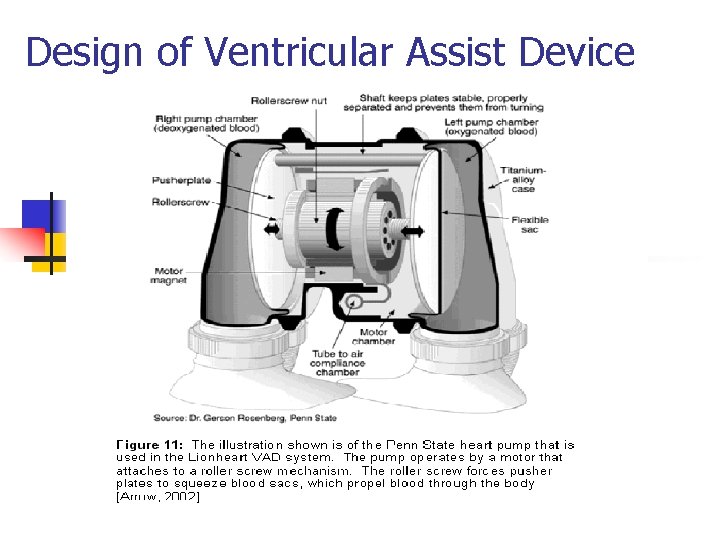 Design of Ventricular Assist Device 