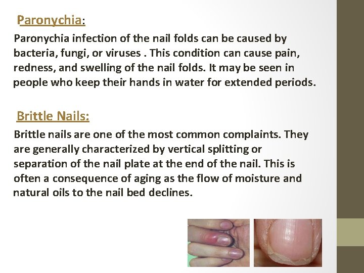 Paronychia: Paronychia infection of the nail folds can be caused by bacteria, fungi, or