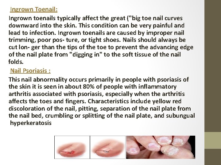 Ingrown Toenail: Ingrown toenails typically affect the great ("big toe nail curves downward into
