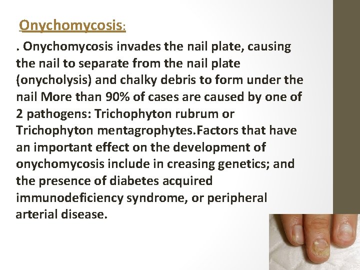 Onychomycosis: . Onychomycosis invades the nail plate, causing the nail to separate from the