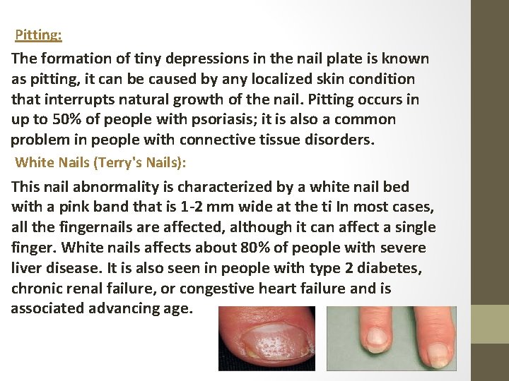 Pitting: The formation of tiny depressions in the nail plate is known as pitting,