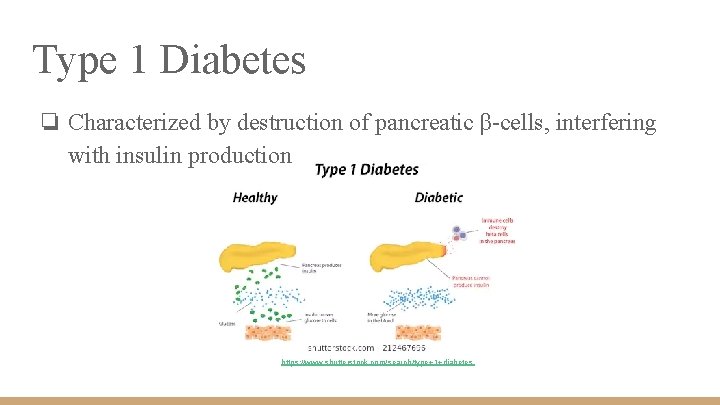 Type 1 Diabetes ❏ Characterized by destruction of pancreatic β-cells, interfering with insulin production