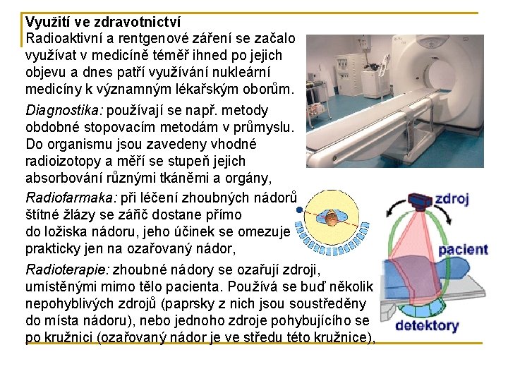 Využití ve zdravotnictví Radioaktivní a rentgenové záření se začalo využívat v medicíně téměř ihned