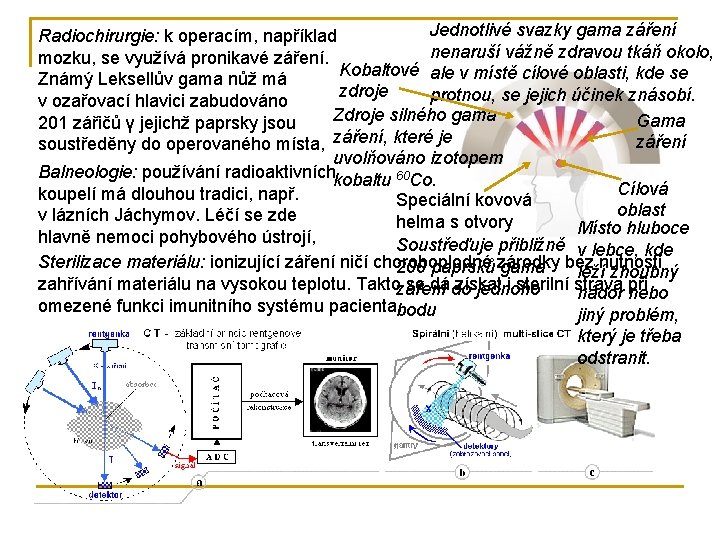 Jednotlivé svazky gama záření Radiochirurgie: k operacím, například nenaruší vážně zdravou tkáň okolo, mozku,