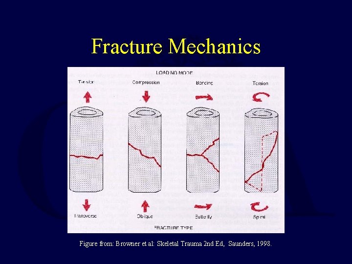 Fracture Mechanics Figure from: Browner et al: Skeletal Trauma 2 nd Ed, Saunders, 1998.