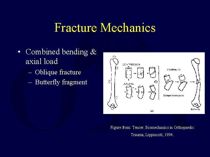 Fracture Mechanics • Combined bending & axial load – Oblique fracture – Butterfly fragment