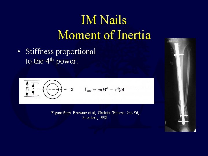 IM Nails Moment of Inertia • Stiffness proportional to the 4 th power. Figure IM Nails Moment of Inertia • Stiffness proportional to the 4 th power. Figure