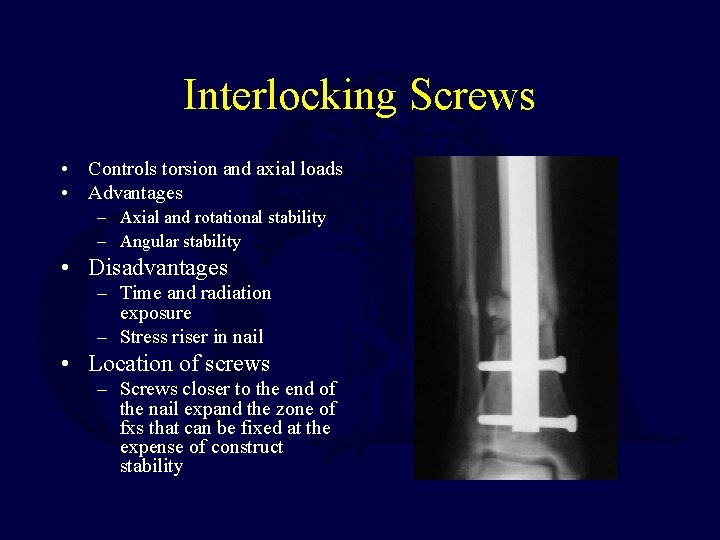 Interlocking Screws • Controls torsion and axial loads • Advantages – Axial and rotational