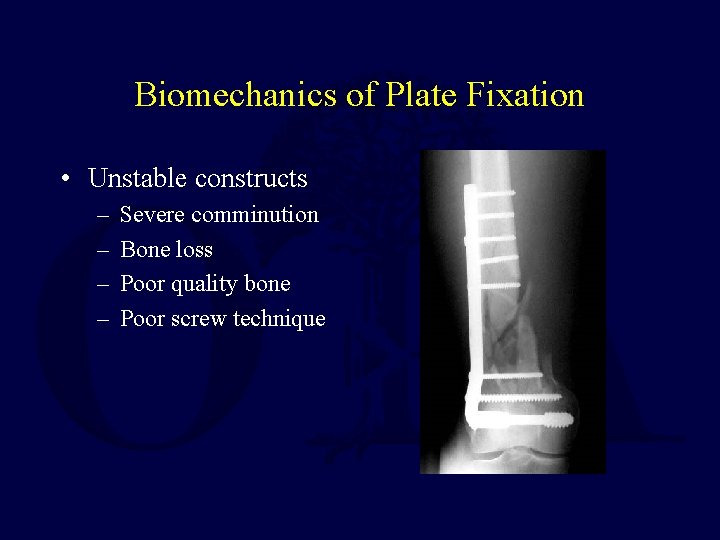 Biomechanics of Plate Fixation • Unstable constructs – – Severe comminution Bone loss Poor