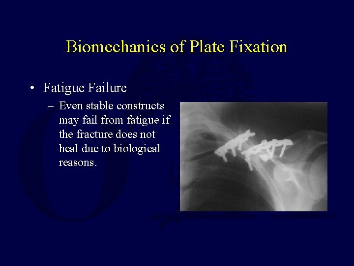 Biomechanics of Plate Fixation • Fatigue Failure – Even stable constructs may fail from