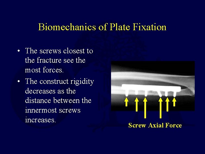 Biomechanics of Plate Fixation • The screws closest to the fracture see the most