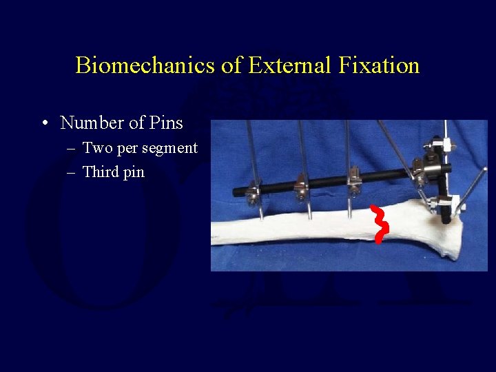 Biomechanics of External Fixation • Number of Pins – Two per segment – Third