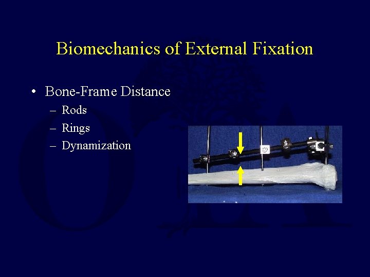 Biomechanics of External Fixation • Bone-Frame Distance – Rods – Rings – Dynamization 