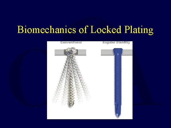 Biomechanics of Locked Plating Biomechanics of Locked Plating