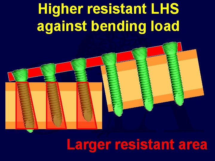 Higher resistant LHS against bending load Larger resistant area 
