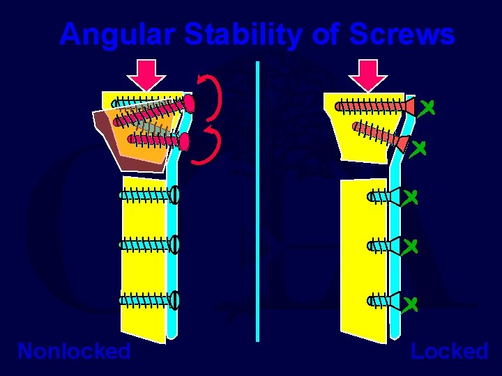 Angular Stability of Screws Nonlocked Locked 