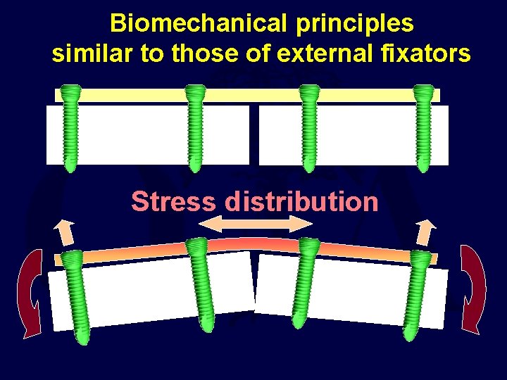 Biomechanical principles similar to those of external fixators Stress distribution 