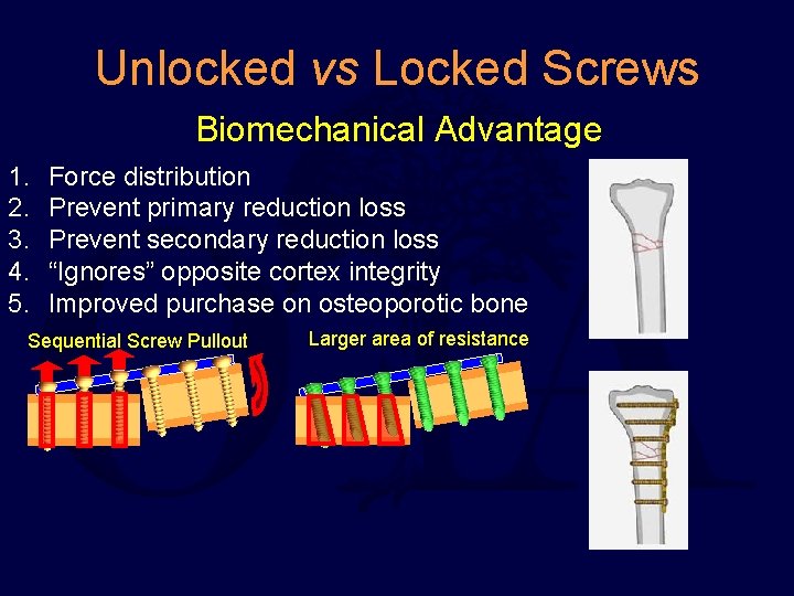 Unlocked vs Locked Screws Biomechanical Advantage 1. 2. 3. 4. 5. Force distribution Prevent