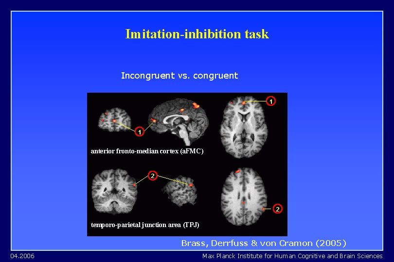 Imitation-inhibition task Incongruent vs. congruent 1 1 anterior fronto-median cortex (a. FMC) 2 2 Imitation-inhibition task Incongruent vs. congruent 1 1 anterior fronto-median cortex (a. FMC) 2 2