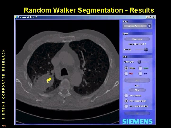 SIEMENS CORPORATE RESEARCH Random Walker Segmentation - Results 108 