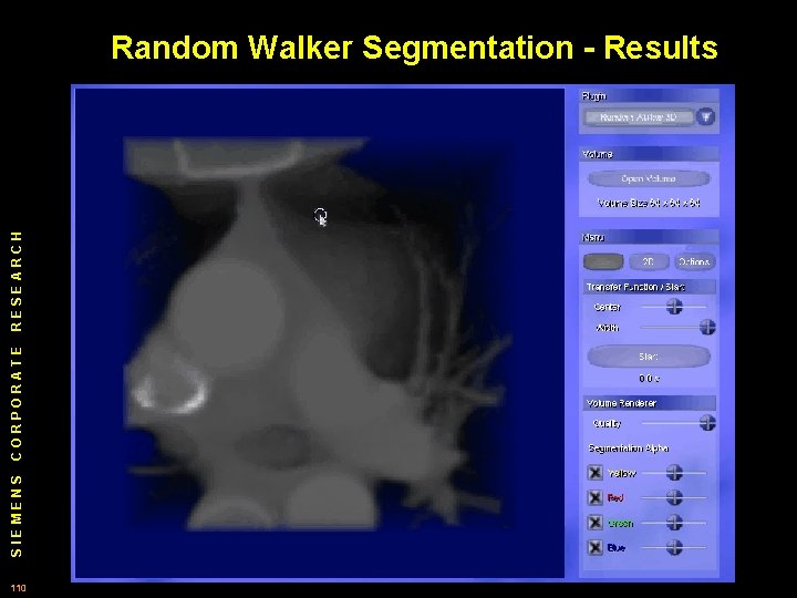 SIEMENS CORPORATE RESEARCH Random Walker Segmentation - Results 110 