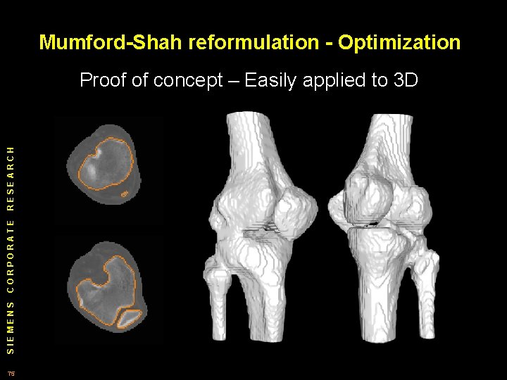 Mumford-Shah reformulation - Optimization SIEMENS CORPORATE RESEARCH Proof of concept – Easily applied to