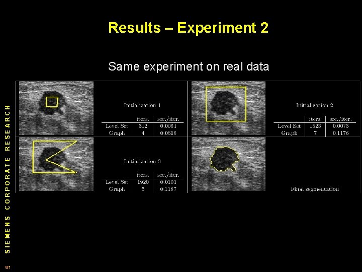 Results – Experiment 2 SIEMENS CORPORATE RESEARCH Same experiment on real data 81 
