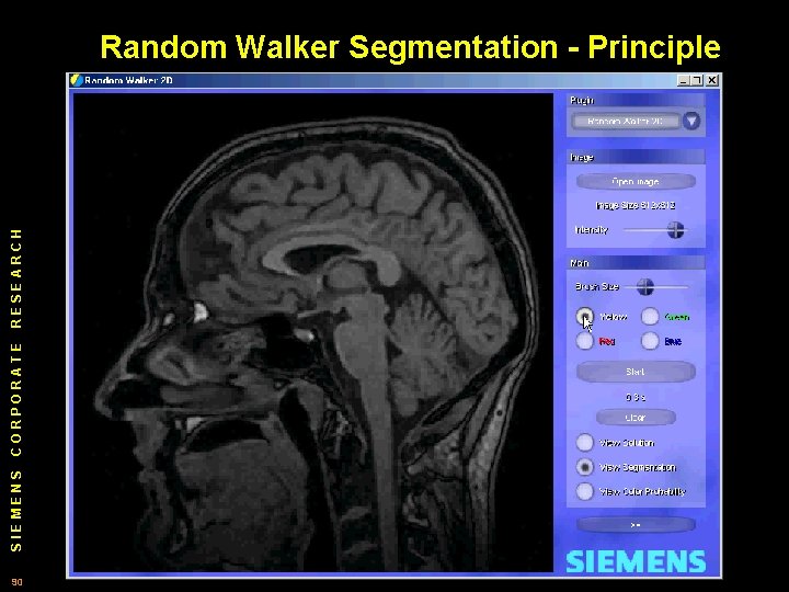 SIEMENS CORPORATE RESEARCH Random Walker Segmentation - Principle 90 