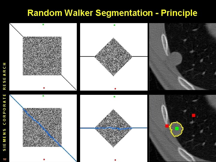 SIEMENS CORPORATE RESEARCH Random Walker Segmentation - Principle 95 