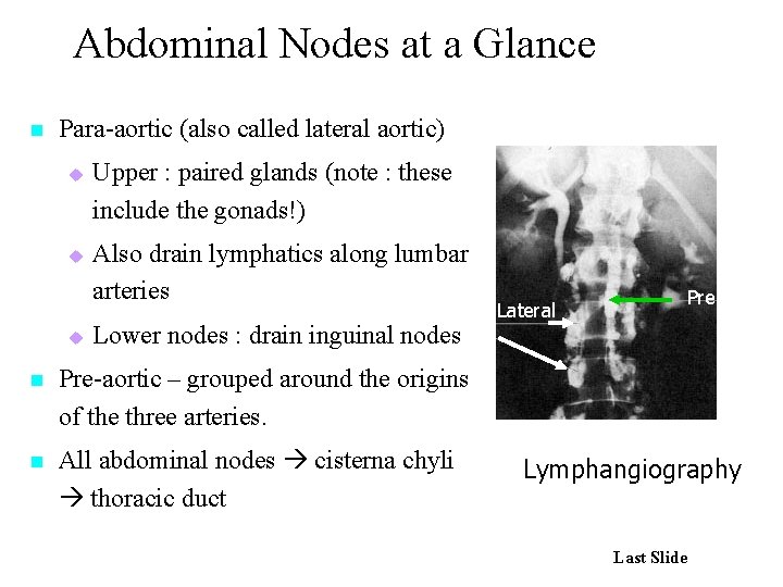 Abdominal Nodes at a Glance n Para-aortic (also called lateral aortic) u u u