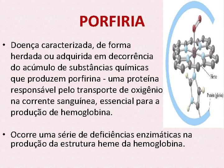 PORFIRIA • Doença caracterizada, de forma herdada ou adquirida em decorrência do acúmulo de