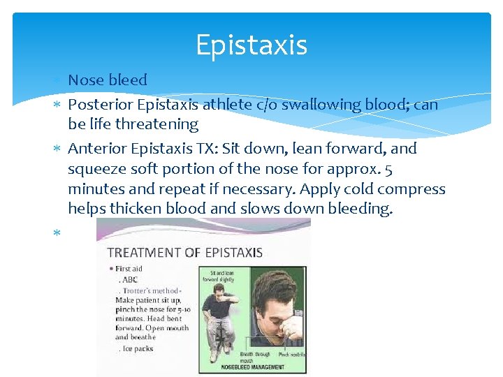 Epistaxis Nose bleed Posterior Epistaxis athlete c/o swallowing blood; can be life threatening Anterior