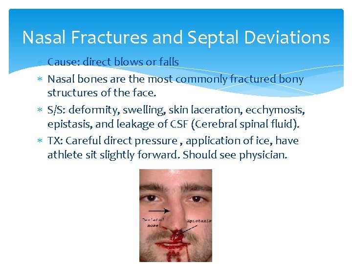 Nasal Fractures and Septal Deviations Cause: direct blows or falls Nasal bones are the