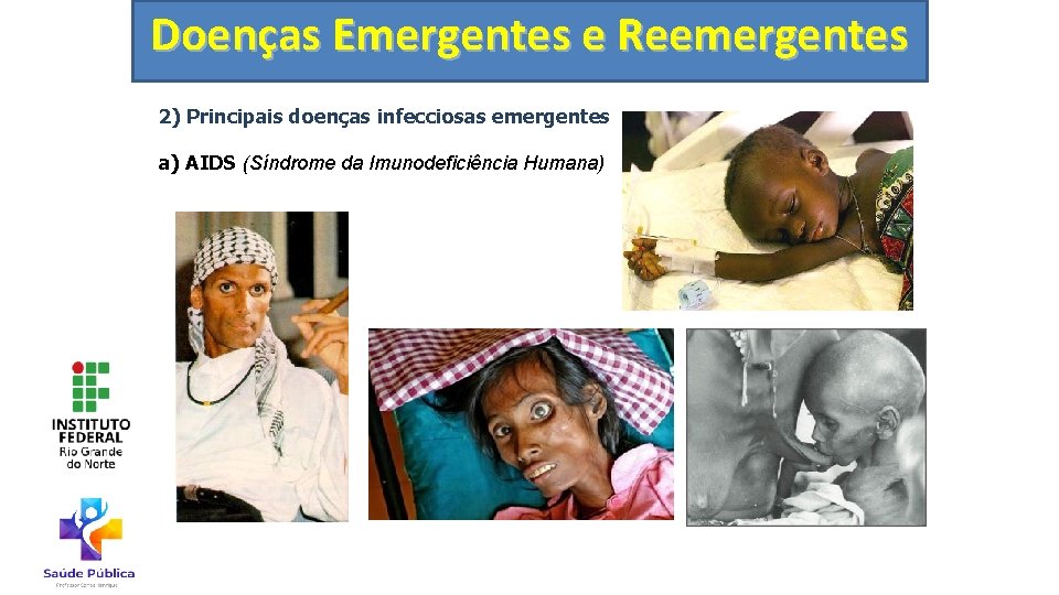 Doenças Emergentes e Reemergentes 2) Principais doenças infecciosas emergentes a) AIDS (Síndrome da Imunodeficiência
