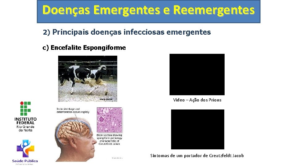 Doenças Emergentes e Reemergentes 2) Principais doenças infecciosas emergentes c) Encefalite Espongiforme Vídeo –