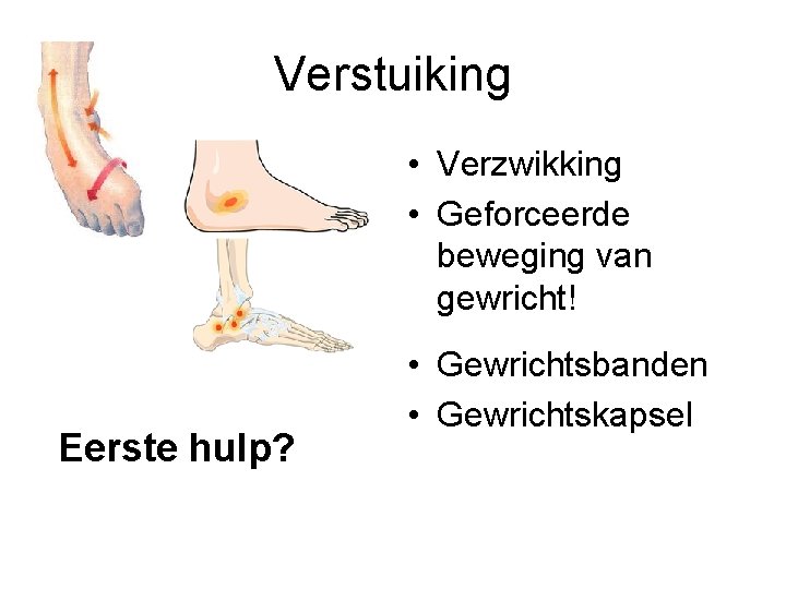 Verstuiking • Verzwikking • Geforceerde beweging van gewricht! Eerste hulp? • Gewrichtsbanden • Gewrichtskapsel