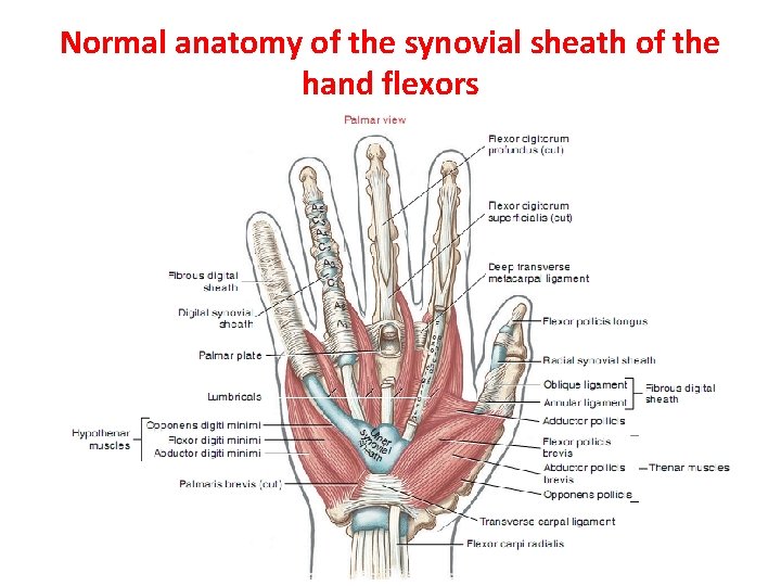 Normal anatomy of the synovial sheath of the hand flexors 