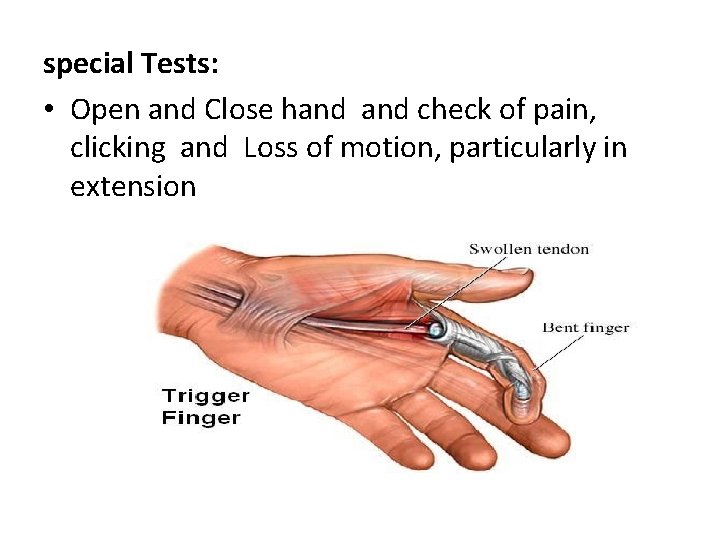 special Tests: • Open and Close hand check of pain, clicking and Loss of