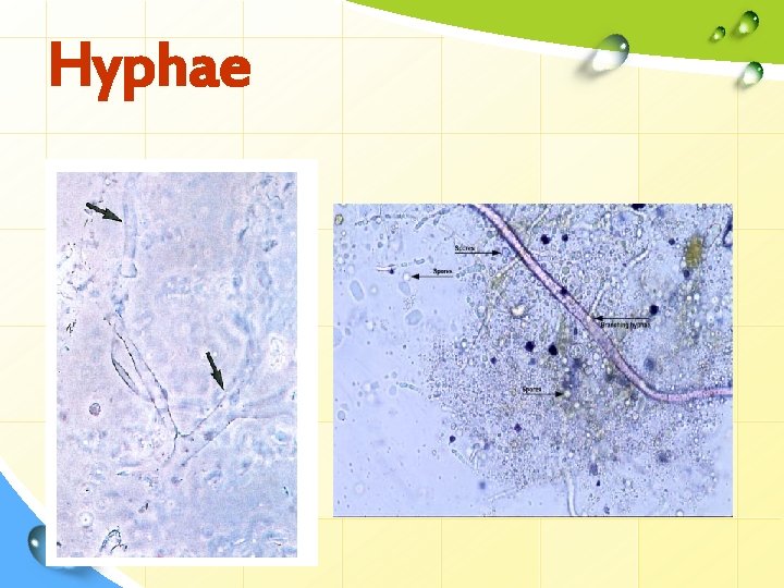 Hyphae 