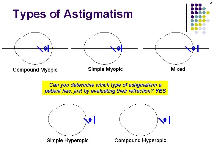2 Types of Astigmatism Compound Myopic Simple Myopic Can you determine which type of