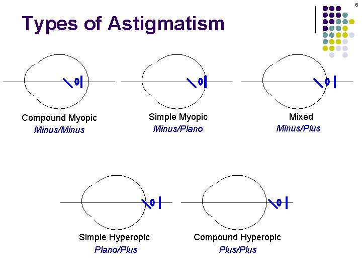 6 Types of Astigmatism Compound Myopic Minus/Minus Simple Myopic Minus/Plano Simple Hyperopic Plano/Plus Mixed