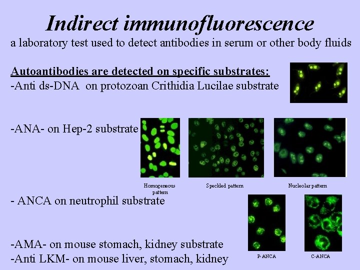 Indirect immunofluorescence a laboratory test used to detect antibodies in serum or other body