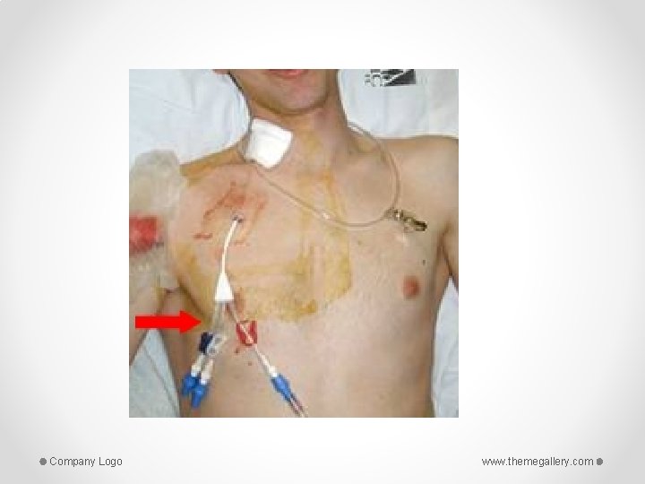 Company Logo www. themegallery. com 