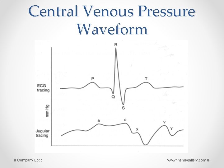 Central Venous Pressure Waveform Company Logo www. themegallery. com 