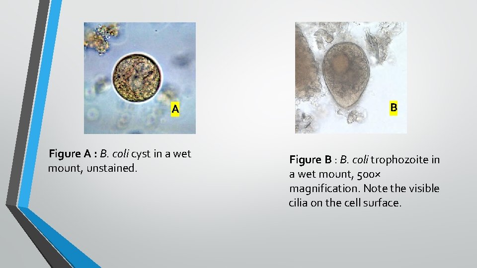 A Figure A : B. coli cyst in a wet mount, unstained. B Figure