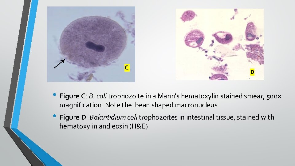 C D • Figure C: B. coli trophozoite in a Mann's hematoxylin stained smear,