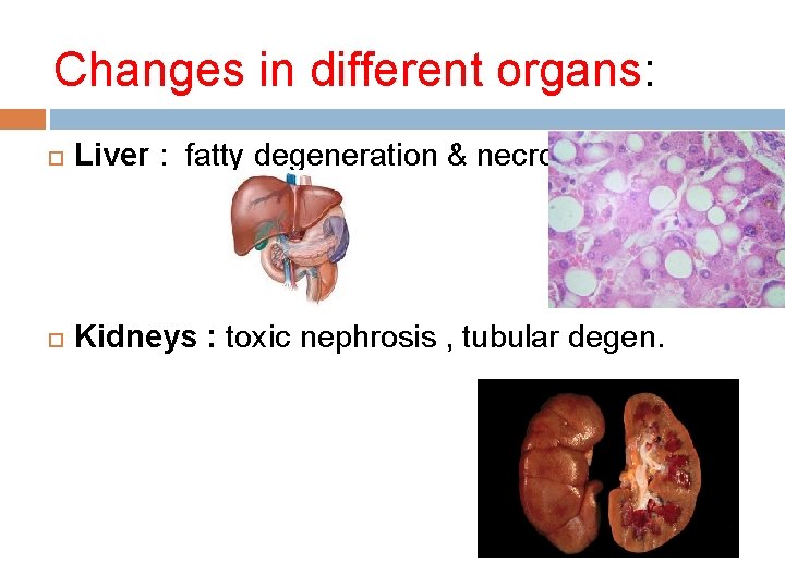 Changes in different organs: Liver : fatty degeneration & necrosis Kidneys : toxic nephrosis